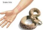 सांप को हाथ से मारने के दौरान सांप ने डस लिया, युवक की मौत